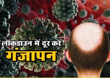 LockDown में घर बैठे ऐसे हो रहा गंजापन दूर