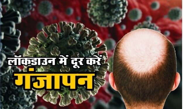 LockDown में घर बैठे ऐसे हो रहा गंजापन दूर