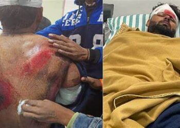 आपने सुना होगा ऋषभ पंत के एक्सीडेंट के बारे में, अब जानिए उनकी लाइफ के कुछ अनछुए किस्से