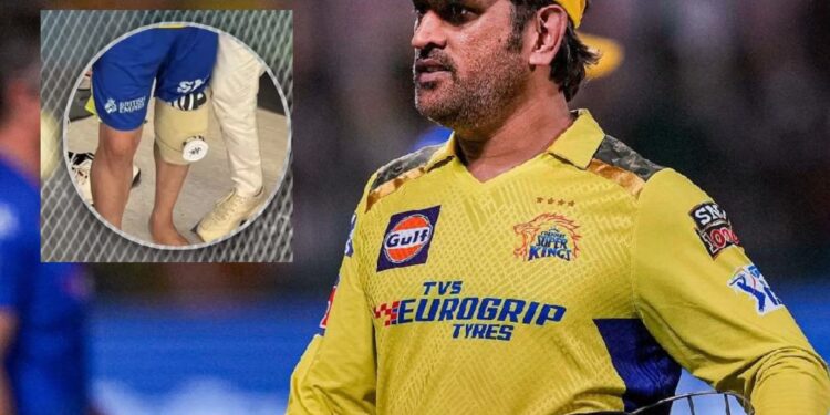 आईपीएल 2023 के तुरंत बाद धोनी ने करवाई घुटनों की सर्जरी, मुंबई के कोकिलाबेन अस्पाताल में हुआ ऑपरेशन