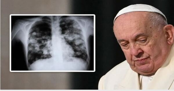 The condition of Catholic Christian religious leader Pope Francis is very critical