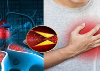 Why is cholesterol a silent killer and how to keep it under control