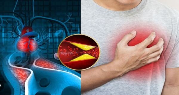 Why is cholesterol a silent killer and how to keep it under control