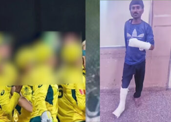 Australian Player Molested Case: इंदौर में आईसीसी महिला विश्व कप दौरान ऑस्ट्रेलियाई क्रिकेटरों से छेड़छाड़, आरोपी हाथ-पैर में पट्टी-प्लास्टर के साथ गिरफ्तार