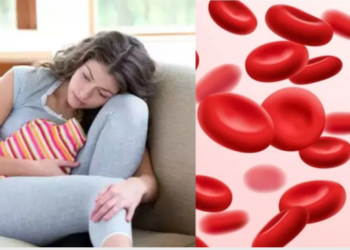 Anemia