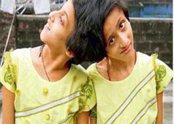 Twin sisters Saba and Farah