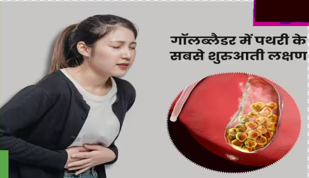5 things really turn into stones in the stomach Which foods can increase the risk of gallstones