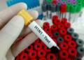 new strain yet swine flu wreaks havoc Find out why