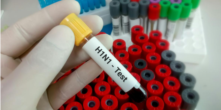 new strain yet swine flu wreaks havoc Find out why
